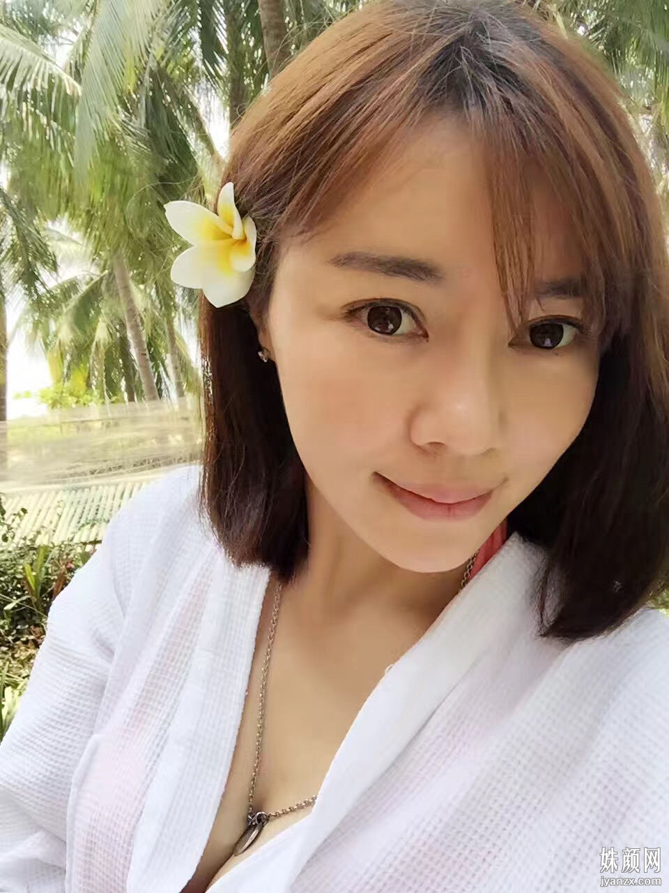 隆鼻恢复过程图