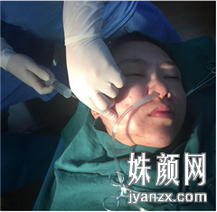 北京炫美医疗美容诊所徐学东全脸脂肪填充+面部吸脂案列恢复图