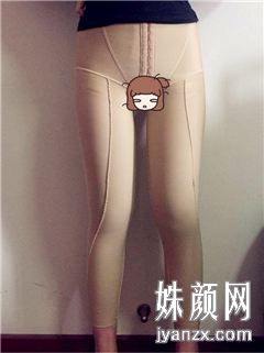 重庆军美医疗美容门诊部大腿收脂+臀线术前图