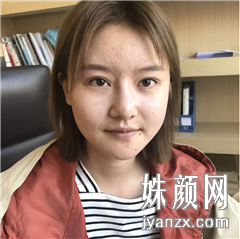 北京叶美人医疗美容诊所张伟面部吸脂+自体脂肪丰胸术前图