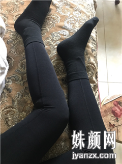 北京金燕子医疗美容诊所赵慧春小腿吸脂恢复图